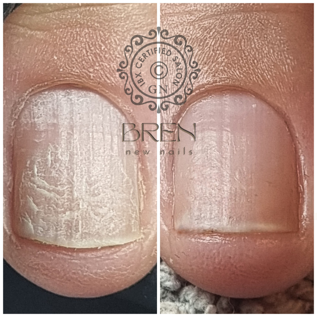 Nagelstudio Raalte Sterkegezondenagels inscheurde nagel foto